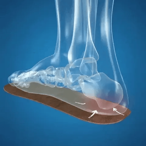 Illustrazione di un piede con plantare ortopedico, evidenziando il supporto dell'arco plantare. Immagine medica su sfondo blu.